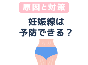 妊娠線　予防 原因　対策